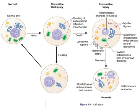 Causes Of Cellular Injury