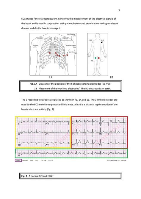 A Student S Guide To Ecg Interpretation Pdf