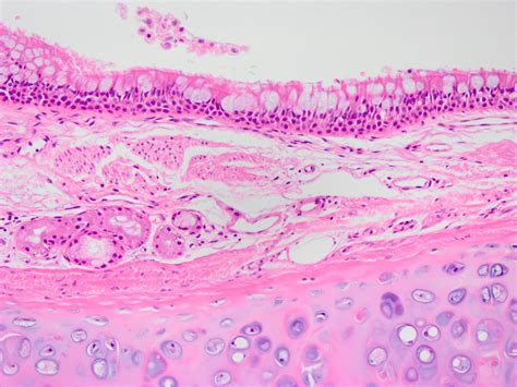 Pathology Outlines Histology