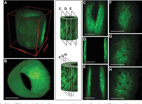 Figure From The Use Of Optical Clearing And Multiphoton Microscopy