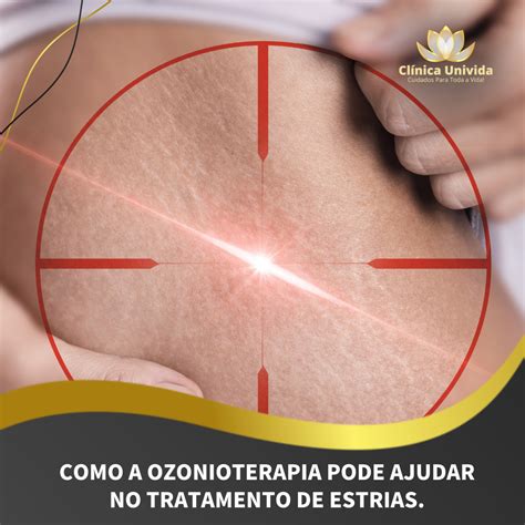 A ozonioterapia é uma macroterapia que reativa a microcirculação