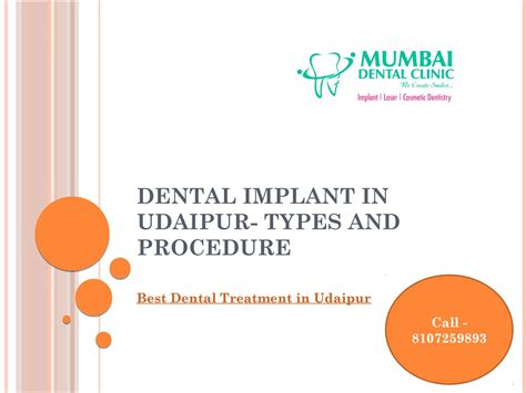 Dental Implant In Udaipur Types And Procedure By Mumbai Dental Clinic