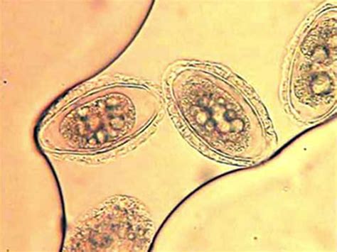 Earthworm In Urethra Telegraph