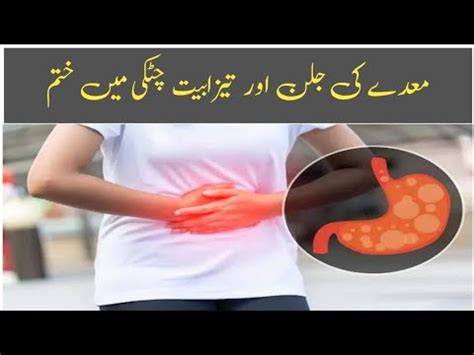 Best Way To Treat Stomach Acidity Stomach Ulcer Stomach Acidity Ka