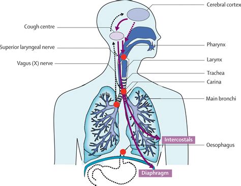 Phlegm In Throat Diagram