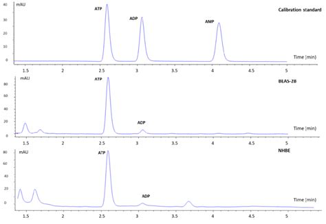 Representative Overlaid Hplc Chromatograms Of Calibration Standard X Download Scientific