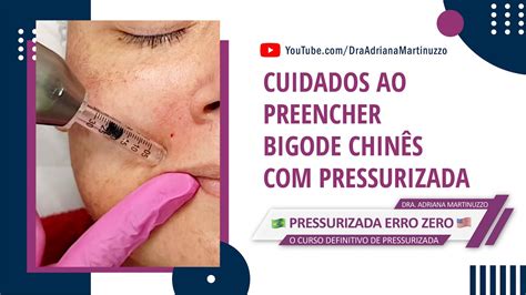 Cuidado Ao Preencher O Bigode Chinês Com A Pressurrizada Youtube