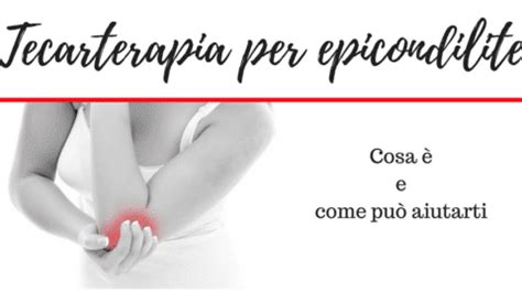 Epicondilite Cosa è e come si cura una guida completa Mdm Fisioterapia