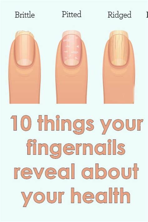 10 Warning Signs From Your Fingernails Reveal About Nail Health Signs