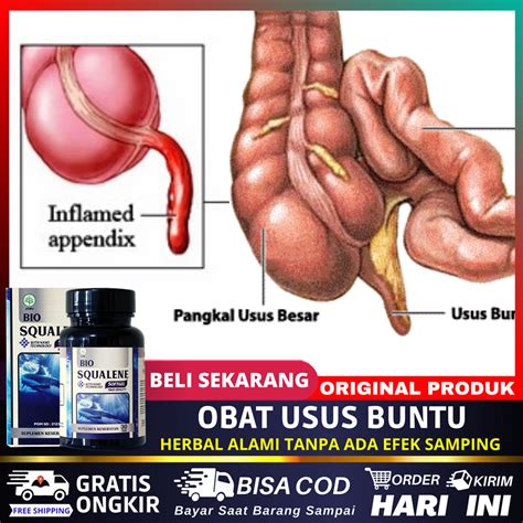 Jual Obat Radang Usus Buntu Kanker Usus Obat Usus Besar Obat Usus