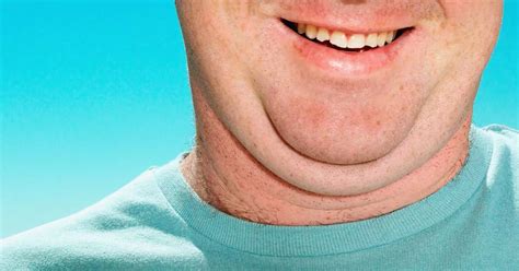 Soon Youll Be Able To Get Rid Of Your Double Chin With An Injection