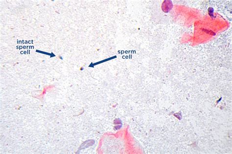 Sperm Cell Slide