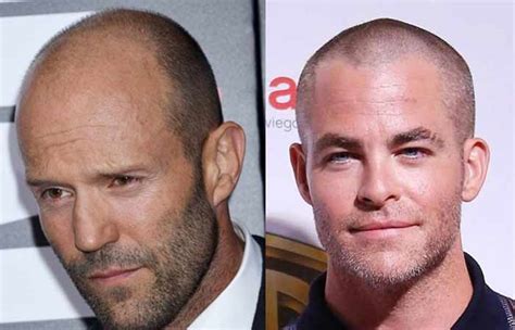 Best Receding Hairline Haircuts Hairstyles Men Hairsentry