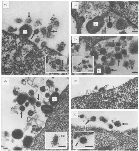 Transmission Electron Micrographs Of Ultrathin Sections From