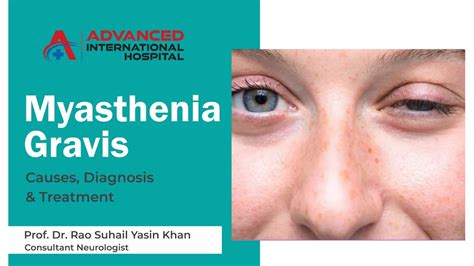 Myasthenia Gravis Causes Diagnosis Treatment By Prof Dr Rao Suhail