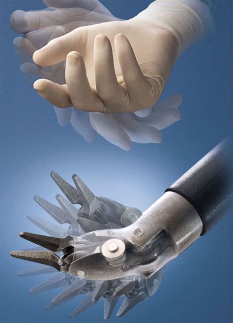 Using Robotics To Advance Minimally Invasive Coronary Bypass Surgery