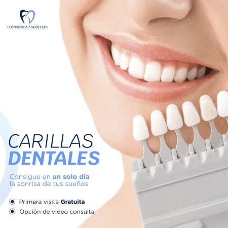 Carillas Dentales En Gij N Implantes Dentales En Gijon