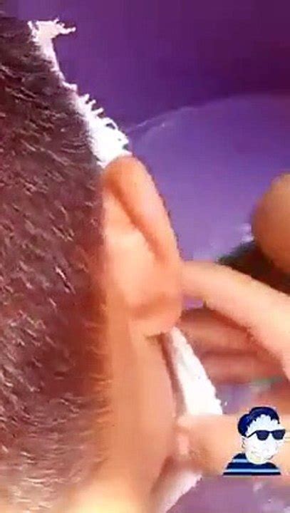 Joven hizo máscara de yeso como tarea y se le pegó en el rostro Vídeo