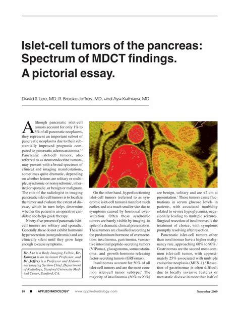 (PDF) 6 Islet-Cell Tumors of the Pancreas - DOKUMEN.TIPS