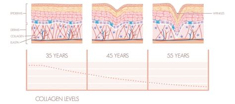 Early Signs Of Aging And How To Treat Them Dream Plastic Surgery