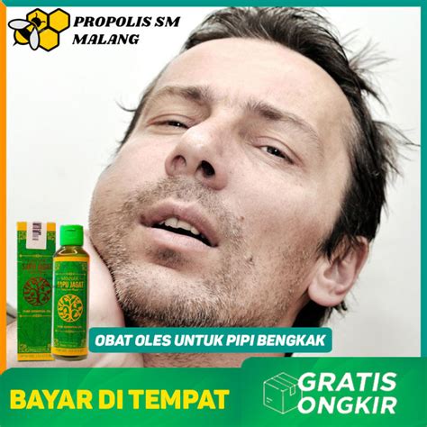 Obat Oles Untuk Pipi Bengkak Karena Sakit Gigi Minyak Sapu Jagat