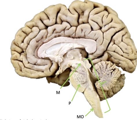 Neuro Brain Stem Cranial Nerves Flashcards Quizlet