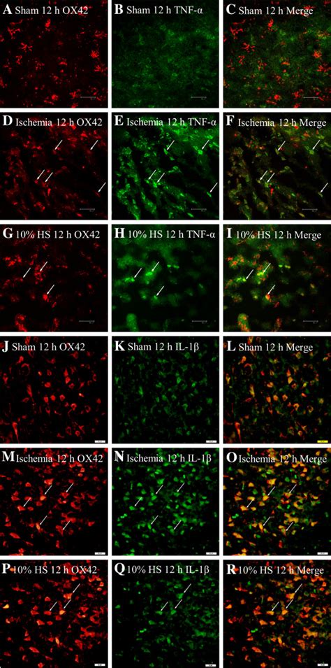 Ten Percent Hs Reduced The Tnf α And Il 1β Expression In Download