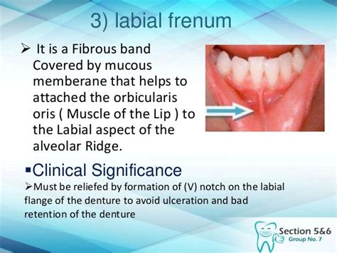 Intra Oral Mandibular Landmarks