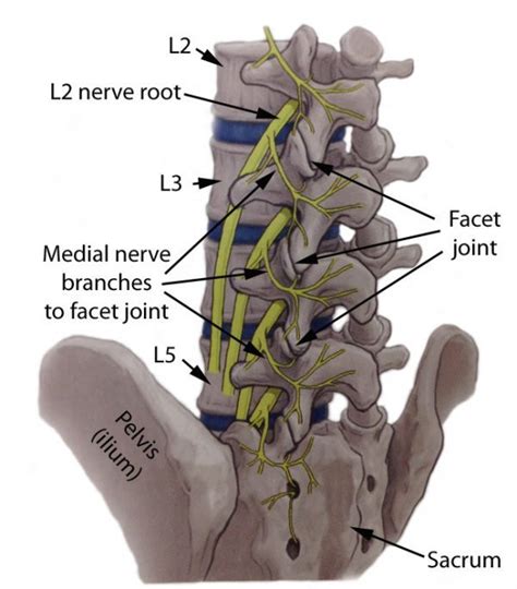 Lumbar Medial Branch Nerve Block