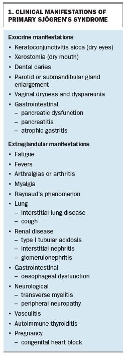 Diagnosis And Management Of Primary Sjögrens Syndrome Medicine Today