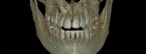 Inicio Oral Rx Diagnóstico Radiológico Radiografías Intraorales Radiografías Extraorales