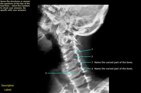 Head And Neck Cervical Spine Oblique View Diagram Quizlet