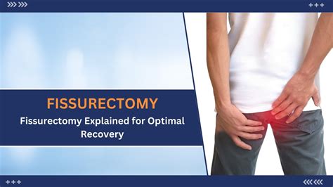 Understanding And Conquering Anal Fissures Through Surgery Wellness Hospitals