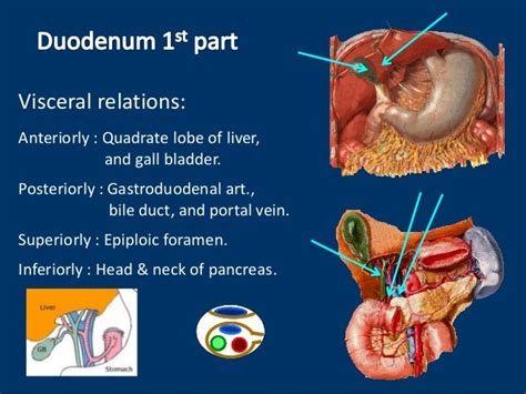 Anatomy Of Duodenum Duodenum Structure Ppt Of Duodenum Power Point