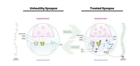 Nncionline Org Clinical Commentary Reshaping The Depressed Brain A