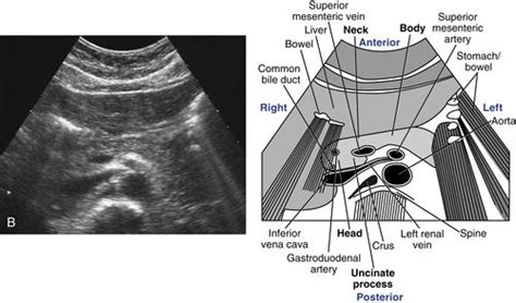 Pancreas Scanning Protocol Radiology Key