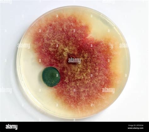 A Petri Dish With Growing Cultures Of Microorganisms Fungi And