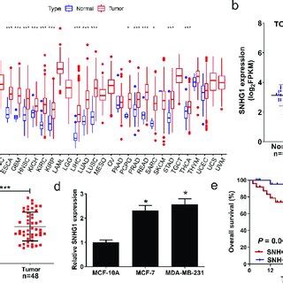 SNHG1 Epigenetically Silenced MiR 381 In Breast Cancer Cells A