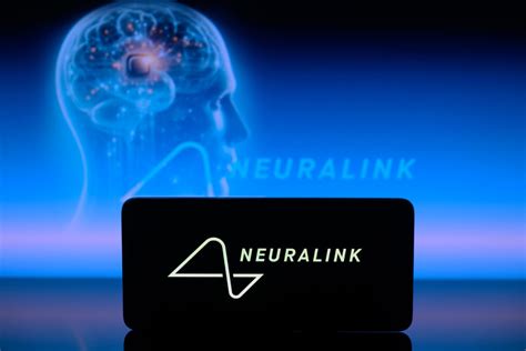 Aquí Hay Un Video Del Primer Paciente Humano De Neuralink Controlando Una Computadora Con Sus