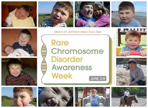 Rare Chromosome Disorder Awareness Week 2nd to 8th June 2014 - Verily Victoria Vocalises