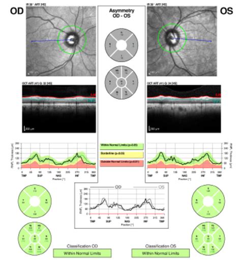 The Larry Alexander Resident Case Report Contest A Rare Case Of Nevus