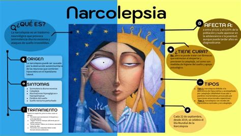 Narcolepsia