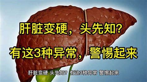 肝脏变硬，头先知？有这3种异常，警惕起来 健康视频 搜狐视频