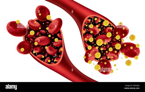 Diabete E Diabete E Glicemia Come Simbolo Di Ipoglicemia E Iperglicemia