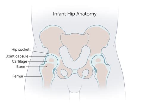 hip dysplasia boston childrens hospital