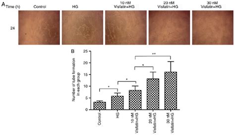 Effect Of Visfatin On The Formation Of Tube Like Structures By Rf A