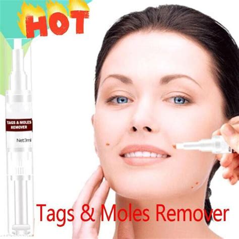 High Quality Wipe Off Tags Moles Remover 3ml Skin Tags Mole Remover