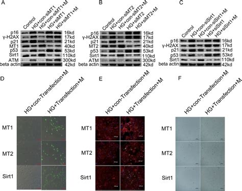 Melatonin Prevented Hginduced Cellular Senescence Via Mt1 Mt2 Sirt1 Download Scientific Diagram