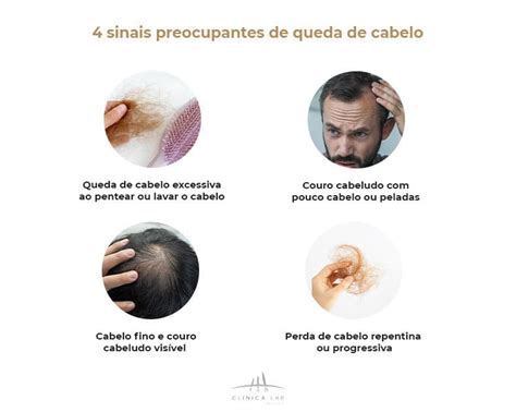 O Que Fazer Para Diminuir A Queda De Cabelo - Queda Excessiva De Cabelo O Que Fazer: Segredos Revelados!