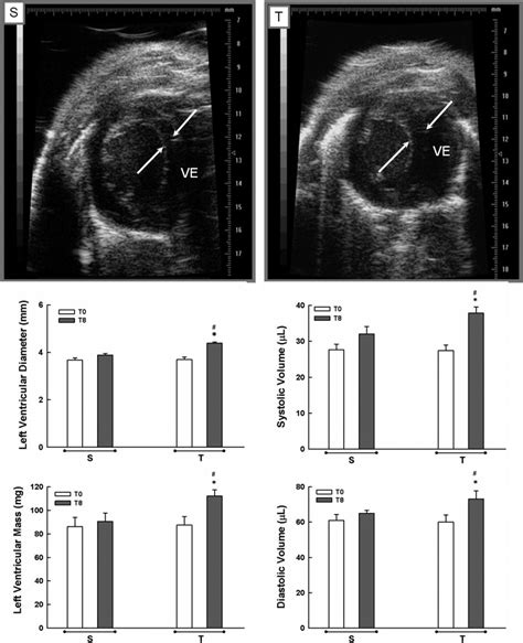 Short Axis B Dimensional Views Of Left Ventricle Lv Top In S And T Download Scientific